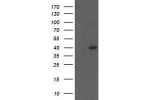 Western Blotting (WB) image for anti-HSPA Binding Protein, Cytoplasmic Cochaperone 1 (HSPBP1) antibody (ABIN1498760) (HSPBP1 anticorps)