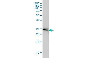 PAFAH1B3 monoclonal antibody (M02), clone 8C11 Western Blot analysis of PAFAH1B3 expression in IMR-32 .