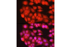 Immunofluorescence analysis of HeLa cells using TRIM63 Rabbit pAb (ABIN3017372, ABIN3017373, ABIN3017374 and ABIN6220060) at dilution of 1:200 (40x lens). (TRIM63 anticorps)