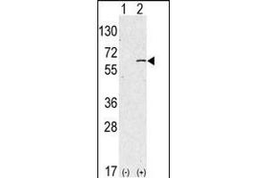 Western blot analysis of anti-hSPHK1-M1 Pab (ABIN391345 and ABIN2841366) in 293 cell line lysates transiently transfected with the SPHK1 gene (2 μg/lane).