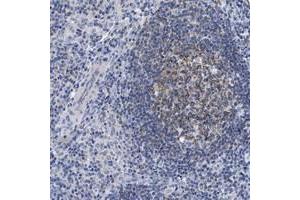 Immunohistochemical staining of human lymph node with LRMP polyclonal antibody  shows moderate cytoplasmic positivity in reaction center cells at 1:500-1:1000 dilution. (LRMP anticorps)