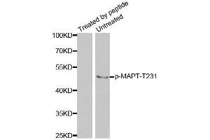 Western blot analysis of extracts from mouse brain tissue using Phospho-MAPT-T231 antibody (ABIN2988163). (MAPT anticorps  (pThr231))