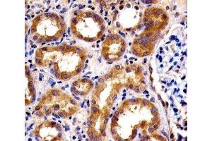 IHC analysis of FFPE human kidney section using SPHK1 antibody; Ab was diluted at 1:100.