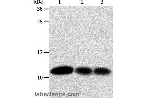 Western blot analysis of Hela and MCF7 cell, human liver cancer tissue, using TXN Polyclonal Antibody at dilution of 1:600 (TXN anticorps)