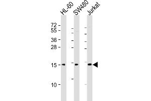 All lanes : Anti-KISS1 Antibody (C-Term) at 1:2000 dilution Lane 1: HL-60 whole cell lysates Lane 2: S whole cell lysates Lane 3: Jurkat whole cell lysates Lysates/proteins at 20 μg per lane. (KISS1 anticorps  (AA 115-145))