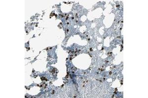 Immunohistochemical staining (Formalin-fixed paraffin-embedded sections) of human bone marrow with TPX2 polyclonal antibody  shows strong nuclear positivity in bone marrow poietic cells. (TPX2 anticorps)