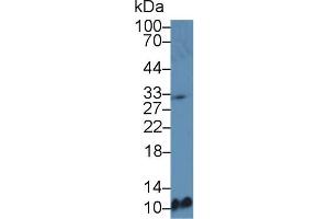 Western blot analysis of Mouse Spleen lysate, using Mouse MDC Antibody (5 µg/ml) and HRP-conjugated Goat Anti-Rabbit antibody ( (CCL22 anticorps  (AA 29-92))