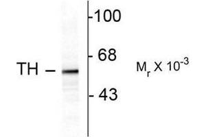 Image no. 1 for anti-Tyrosine Hydroxylase (TH) antibody (ABIN372735) (Tyrosine Hydroxylase anticorps)