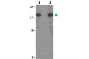 Western blot analysis of TSC22D3 in human small intestine tissue with TSC22D3 polyclonal antibody  at (lane 1) 1 and (lane 2) 2 ug/mL. (TSC22D3 anticorps  (N-Term))
