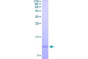 Image no. 1 for Peptidase Inhibitor 3, Skin-Derived (PI3) (AA 61-117) protein (His-DYKDDDDK-Strep II Tag) (ABIN4369875)