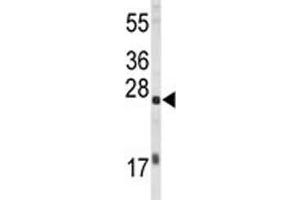 Western blot analysis of EIF4E antibody and HL-60 lysate. (EIF4E anticorps)