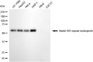 Western blotting analysis using aladin WD repeat nucleoporin antibody (ABIN7797447).