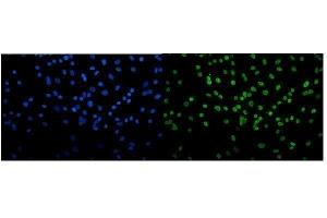 IF analysis of Transketolase/TKT using anti-Transketolase/TKT antibody (ABIN7598958). (TKT anticorps  (AA 1-116))