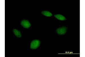 Immunofluorescence of purified MaxPab antibody to PHF21B on HeLa cell. (PHF21B anticorps  (AA 1-531))