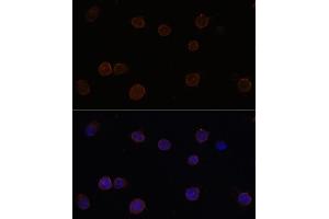 anti-Anoctamin 2 (ANO2) (AA 1-200) antibody