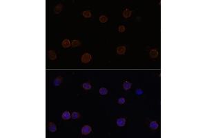 Immunofluorescence analysis of Y79 cells using  Polyclonal Antibody (ABIN6129705, ABIN6136904, ABIN6136906 and ABIN6220328) at dilution of 1:100 (40x lens). (Anoctamin 2 anticorps  (AA 1-200))