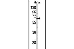 Western blot analysis of CTPS2 Antibody (N-term) (ABIN652725 and ABIN2842481) in Hela cell line lysates (35 μg/lane). (CTPS2 anticorps  (N-Term))