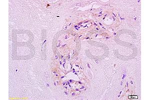 Formalin-fixed and paraffin embedded human placenta tissue labeled with Anti MFSD2A Polyclonal Antibody, unconjugated (ABIN762026) at 1:200 followed by incubation with conjugated secondary antibody and DAB staining (MFSD2A anticorps  (AA 331-430))