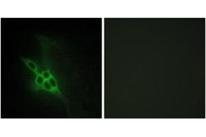 Immunofluorescence analysis of NIH-3T3 cells, using EPHB1/2/3 Antibody. (EPH Receptor B1/2/3 (AA 631-680) anticorps)