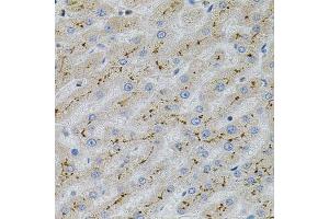 Immunohistochemistry of paraffin-embedded human liver injury using MAPK1 antibody.