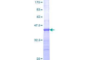 Image no. 1 for Interleukin 1 Receptor, Type I (IL1R1) (AA 18-127) protein (GST tag) (ABIN1307755)