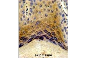 Formalin-fixed and paraffin-embedded human skin tissue reacted with C1QTNF1 Antibody (N-term), which was peroxidase-conjugated to the secondary antibody, followed by DAB staining.