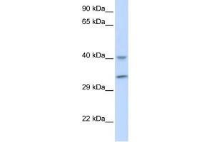 WB Suggested Anti-ALKBH3 Antibody Titration: 0. (ALKBH3 anticorps  (Middle Region))