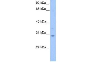 WB Suggested Anti-DCUN1D3 Antibody Titration: 0. (DCUN1D3 anticorps  (C-Term))