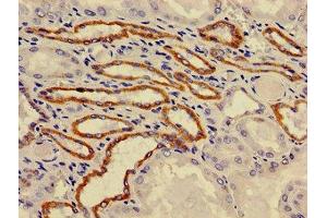 Immunohistochemistry of paraffin-embedded human kidney tissue using ABIN7175212 at dilution of 1:100 (ATP6V0A1 anticorps  (Isoform 1))