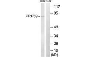 Western blot analysis of extracts from K562 cells, using PRPF39 Antibody.
