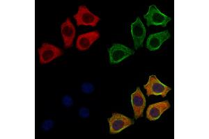 ABIN6261855 and ABIN6272633 staining HepG2 cells by IF/ICC. (GABARAPL2 anticorps  (N-Term))