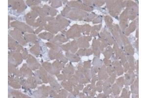 Detection of SLC25A20 in Rat Cardiac Muscle Tissue using Polyclonal Antibody to Solute Carrier Family 25 Member 20 (SLC25A20)