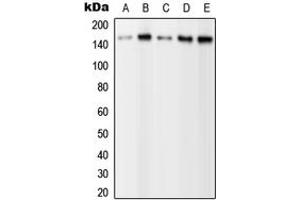 Western blot analysis of PLC gamma 2 (pY1217) expression in HEK293T EGF-treated (A), A431 (B), NIH3T3 (C), SP2/0 EGF-treated (D), H9C2 EGF-treated (E) whole cell lysates. (Phospholipase C gamma 2 anticorps  (C-Term, pTyr1217))