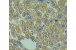 Used in DAB staining on fromalin fixed paraffin- embedded Kidney tissue