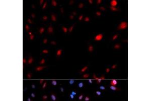 Immunofluorescence analysis of MCF-7 cells using Phospho-CDK1(Y15) Polyclonal Antibody (CDK1 anticorps  (pTyr15))