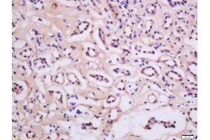 Formalin-fixed and paraffin embedded Human kidney tissue labeled with Anti-PKC epsilon Polyclonal Antibody, Unconjugated 1:200 followed by conjugation to the secondary antibody and DAB staining