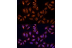 Immunofluorescence analysis of U2OS using AGPS antibody (ABIN6129641, ABIN6136644, ABIN6136645 and ABIN6214756) at dilution of 1:100 (40x lens).