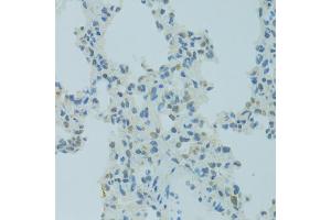 Immunohistochemistry of paraffin-embedded rat lung using MBD2 antibody (ABIN1873650) at dilution of 1:100 (40x lens). (MBD2 anticorps)