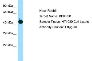 Host: RabbitTarget Name: BDKRB1Antibody Dilution: 1.