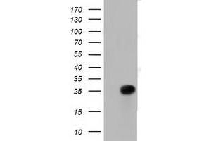 Western Blotting (WB) image for anti-Ras-Like Without CAAX 2 (RIT2) antibody (ABIN1500713) (RIT2 anticorps)