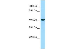 WB Suggested Anti-NKAP Antibody Titration: 1. (NKAP anticorps  (C-Term))