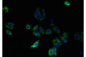 Immunofluorescent analysis of HepG2 cells using ABIN7170183 at dilution of 1:100 and Alexa Fluor 488-congugated AffiniPure Goat Anti-Rabbit IgG(H+L) (SLC25A33 anticorps  (AA 66-120))