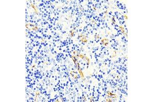 Immunohistochemistry of paraffin-embedded mouse spleen using Caveolin-1 Rabbit mAb (ABIN7266154) at dilution of 1:100 (40x lens).