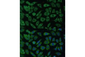 Immunofluorescence analysis of L929 cells using  Polyclonal Antibody (ABIN7265493) at dilution of 1:100 (40x lens).