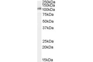 Image no. 1 for anti-Insulin-Degrading Enzyme (IDE) (Internal Region) antibody (ABIN375106) (IDE anticorps  (Internal Region))