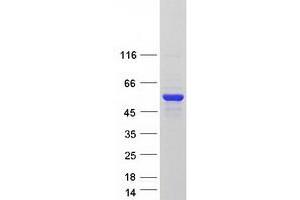 Validation with Western Blot