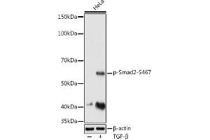 Western blot analysis of extracts of HeLa cells, using Phospho-Smad2-S467 antibody (ABIN3019982, ABIN3019983, ABIN3019984 and ABIN1682048) at 1:1000 dilution.