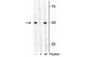 Western blot of Arabidopsis lysate showing specific immunolabeling of the ~53 kDa S6K1 phosphorylated at Thr449 in the first lane (-). (RPS6KB1 anticorps  (pThr449))