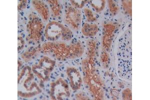 Used in DAB staining on fromalin fixed paraffin- embedded kidney tissue