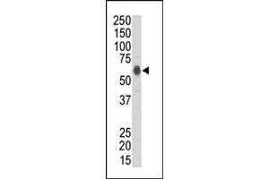 Image no. 1 for anti-Kinase Suppressor of Ras 1 (KSR1) (N-Term) antibody (ABIN360141) (KSR1 anticorps  (N-Term))